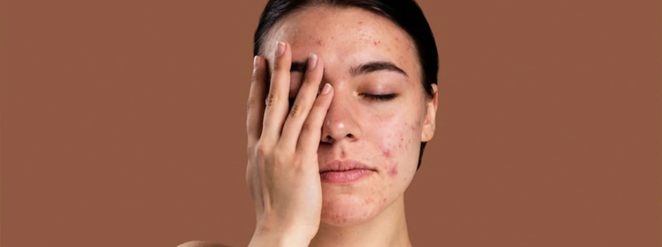 Image Skincare 